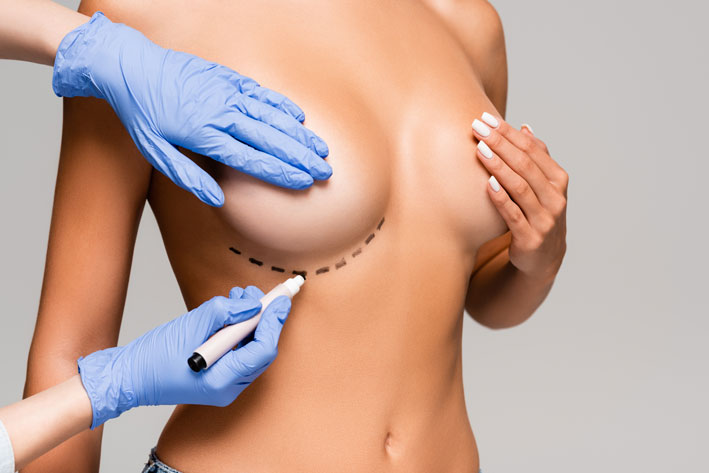 Cropped view of plastic surgeon marking line on breast of naked woman isolated on grey