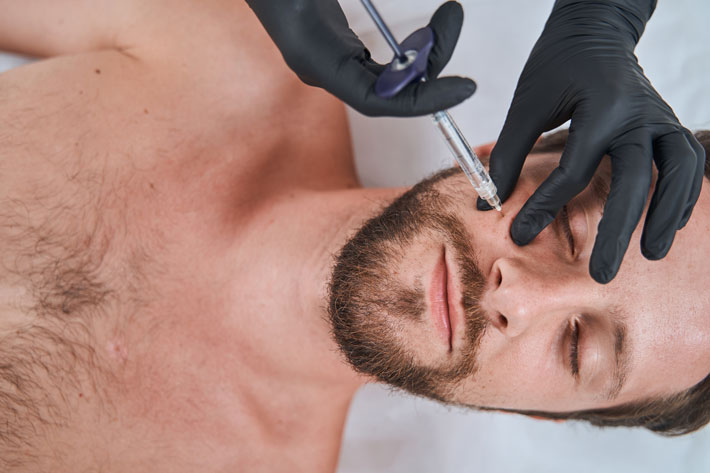 Man getting a dermal fillers lying with his eyes closed during the mesotherapy procedure performed by a certified doctor