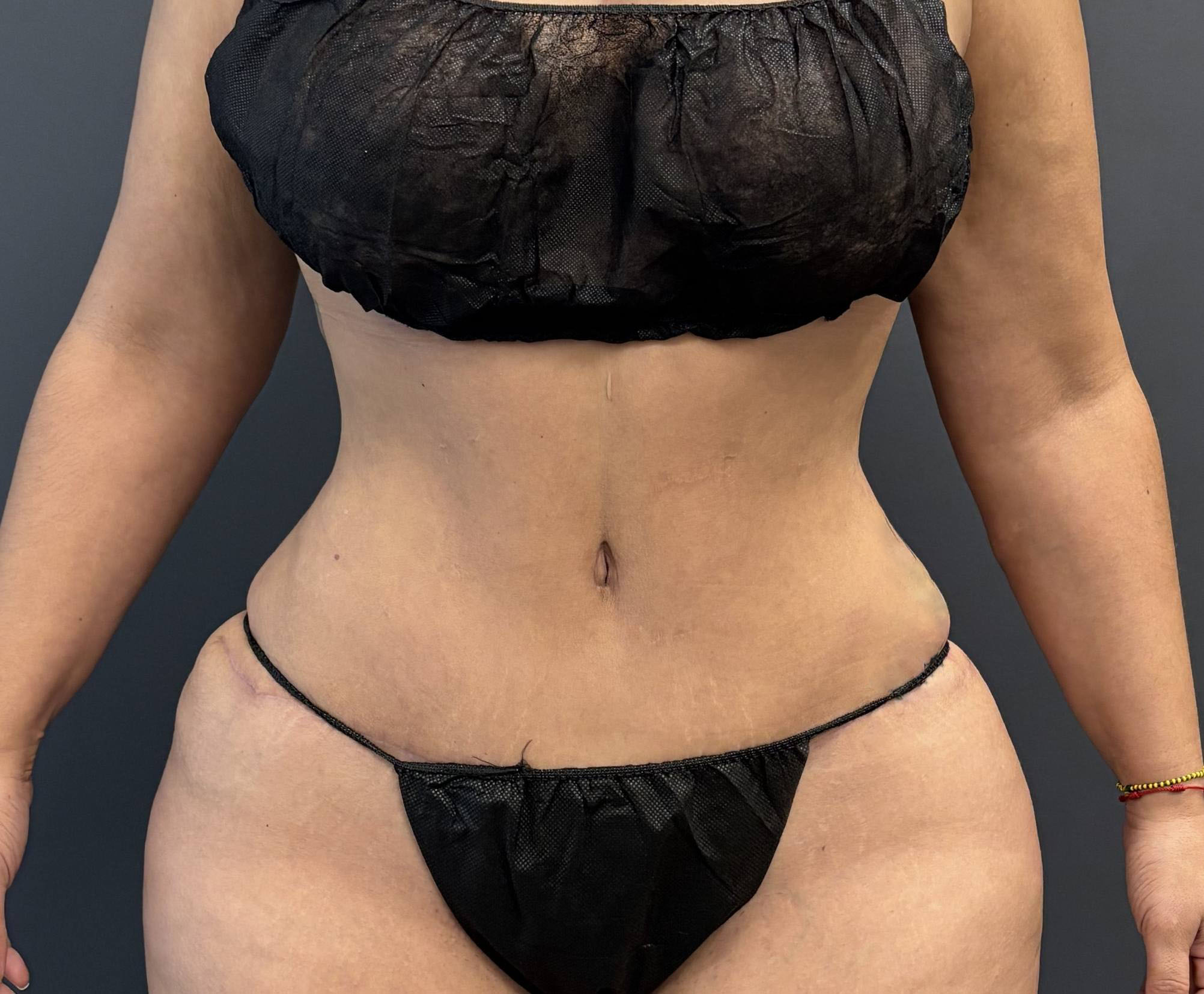 Priscilla Medeiros - 1