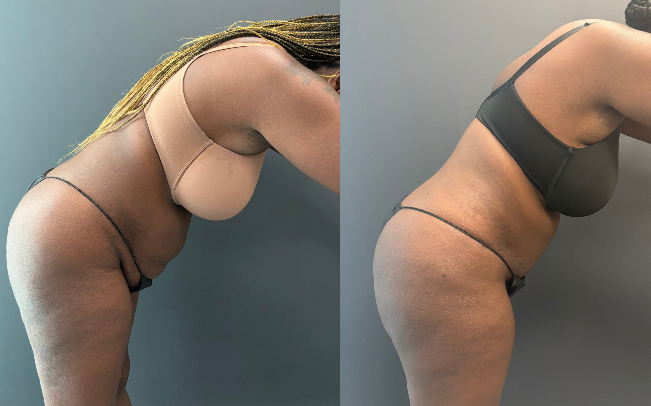 Before and after result 1