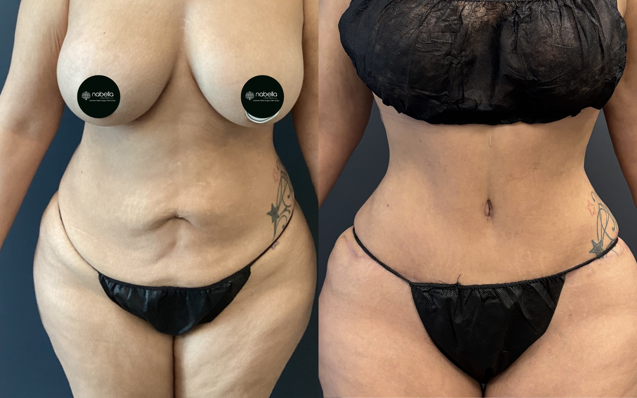 Before and after result 1