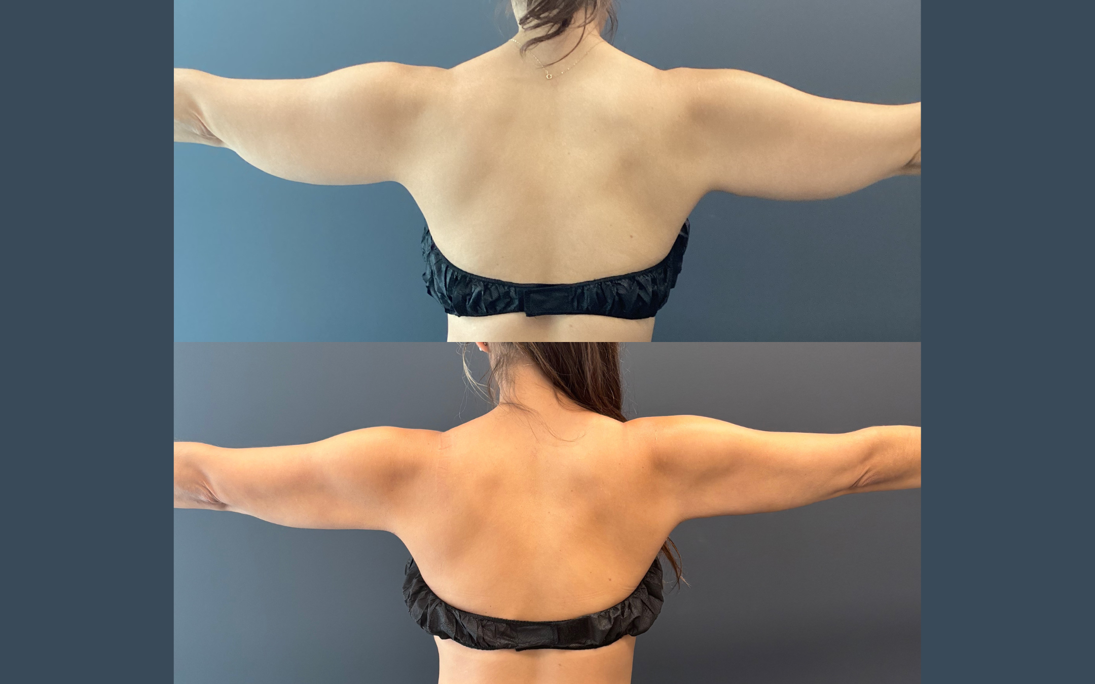 Before and after result 1