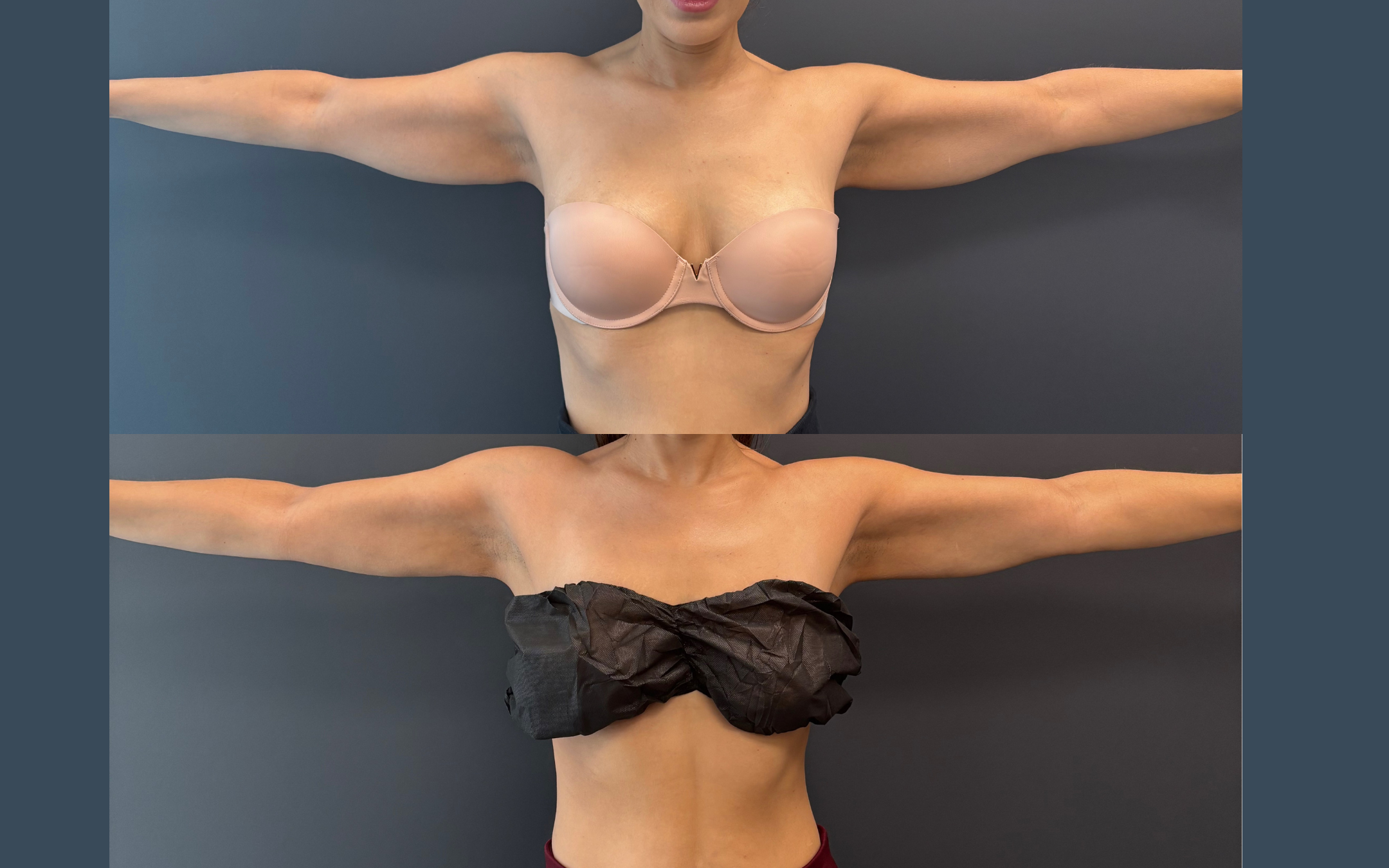 Before and after result 2