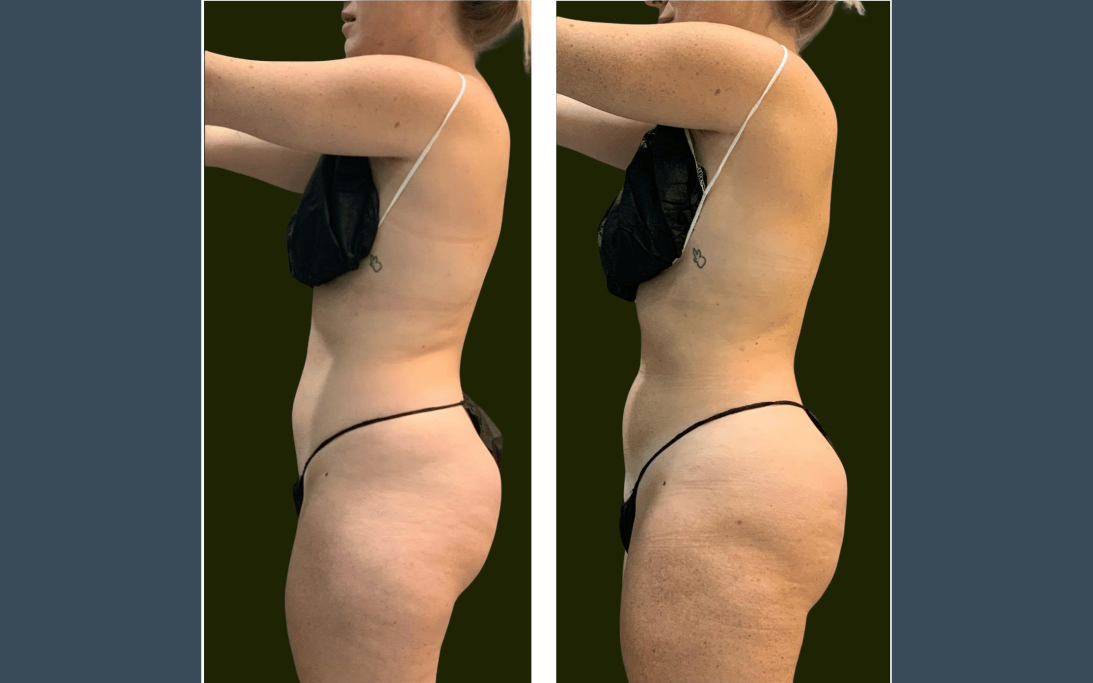 Before and after result 1