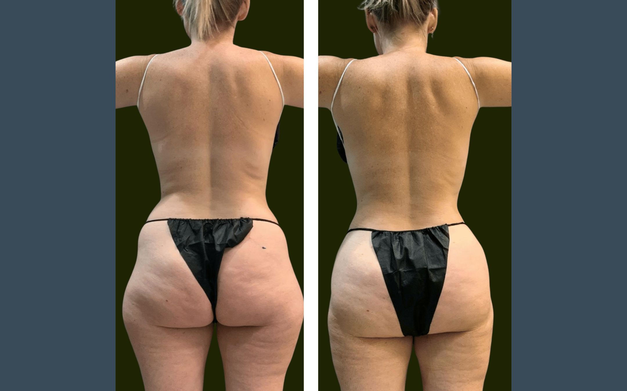 Before and after result 1